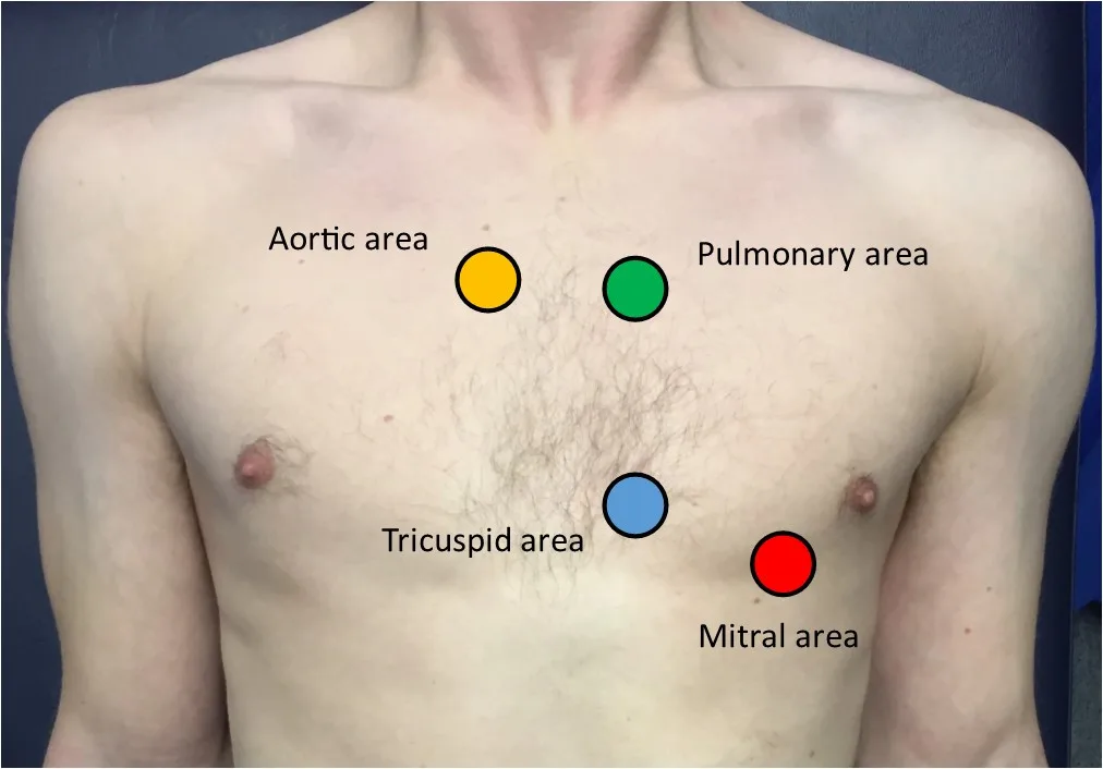 Chest auscultation sites labeled: aortic, pulmonary, tricuspid, mitral areas. Focus on heart sound examination.