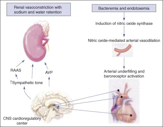 Flowchart of renal vasoconstriction with sodium retention vs. nitric oxide-mediated arterial vasodilation processes.